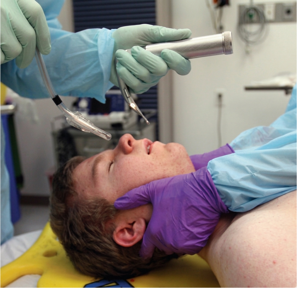 Airway anatomy