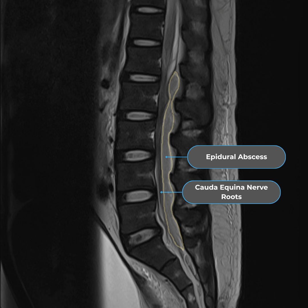 Sagittal SEA MRI