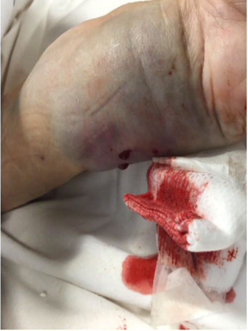 Open distal radius clinical image