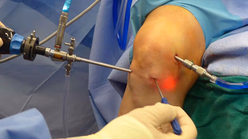 Surgical management image